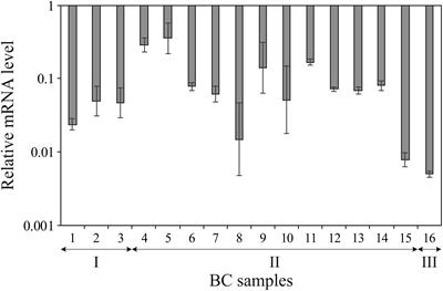 Deep Sequencing Revealed a CpG Methylation Pattern Associated With ALDH1L1 Suppression in Breast Cancer